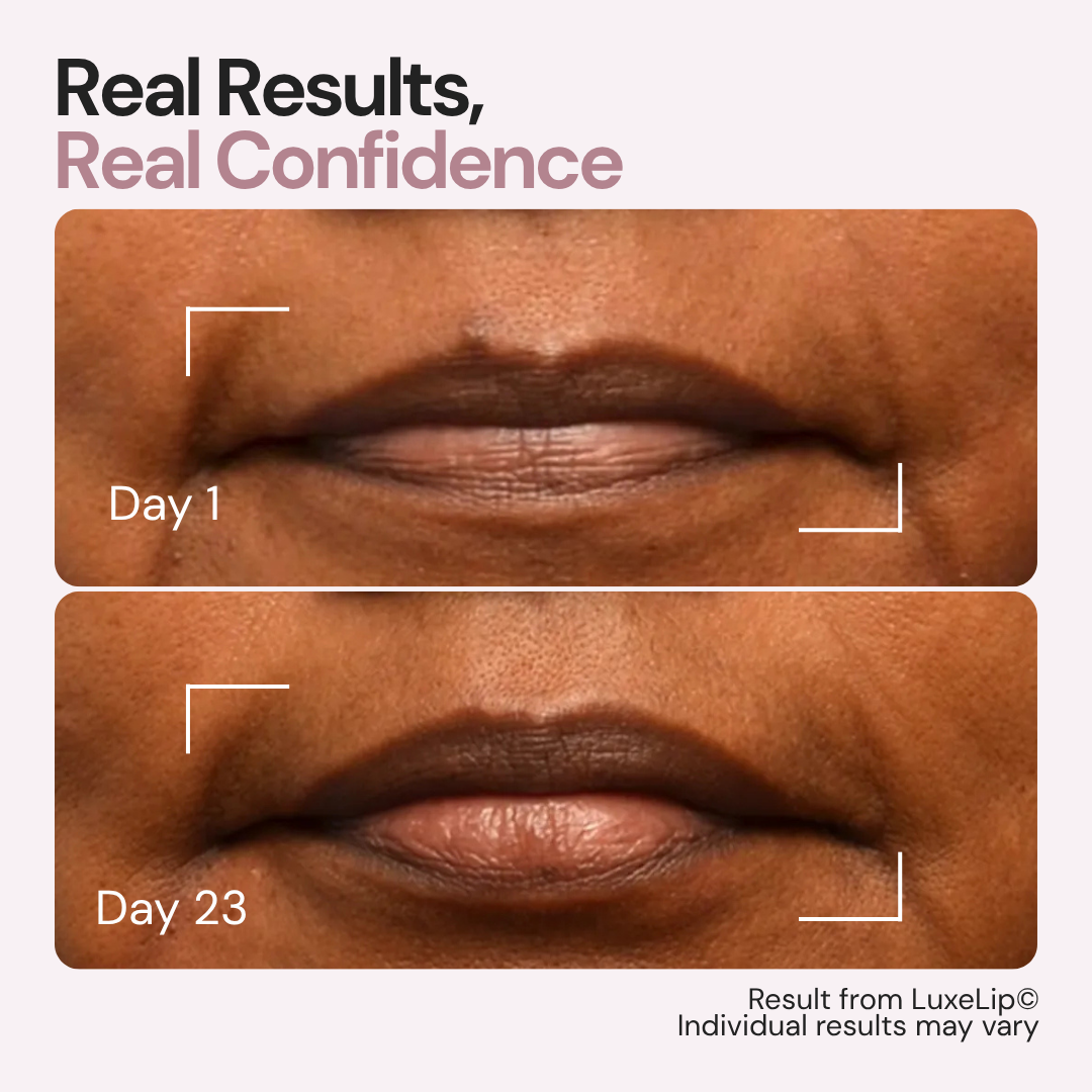 LuxeLip© Erase Lip Lines Without Injections in Just 6 min a day