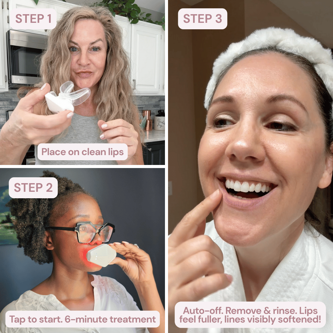 LuxeLip© Erase Lip Lines Without Injections in Just 6 min a day